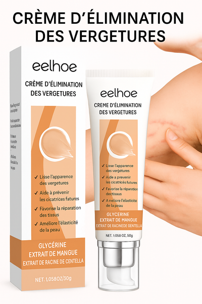 Crème Anti-Vergetures Réparatrice et Lissante – Soin Intensif Peau Sublimée