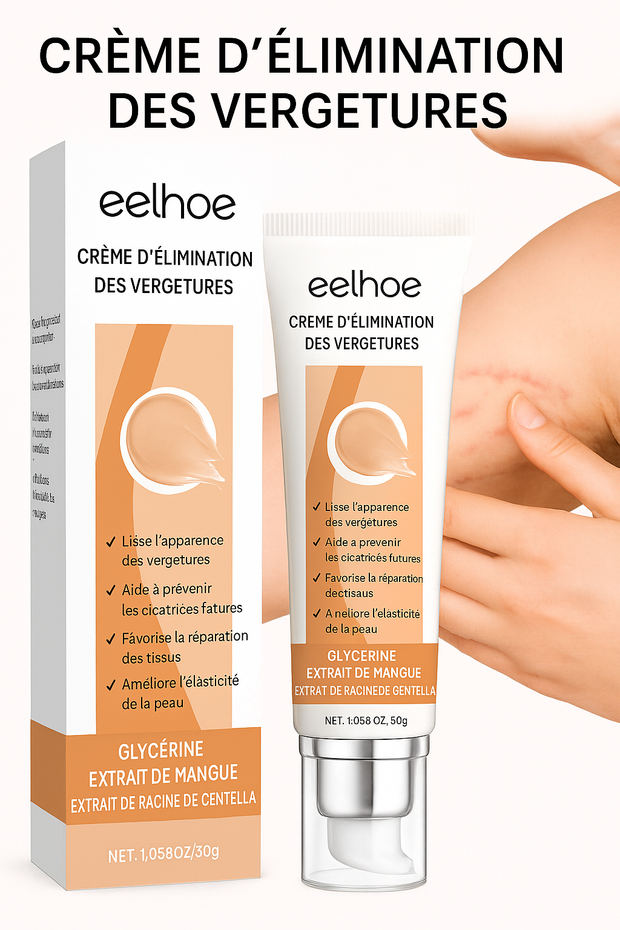 Crème Anti-Vergetures Réparatrice et Lissante – Soin Intensif Peau Sublimée.